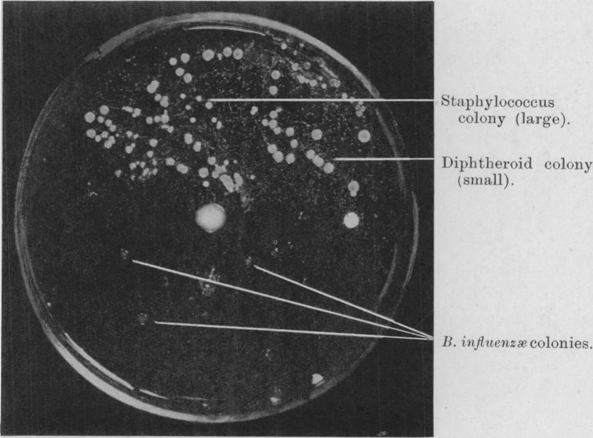 Fig. 4—Photograph of a culture-plate (Fildes medium) which had been evenly planted with nasal mucus from an individual suffering from a “cold.” Six drops of penicillin were spread over the lower half of the plate before incubation. Note profuse growth of staphylococci and diphtheroid bacilli in untreated half, whereas in treated half only some three colonies of B. influenzæ are seen.