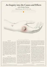 An Inquiry into the Causes and Effects of the Variolæ Vaccinæ