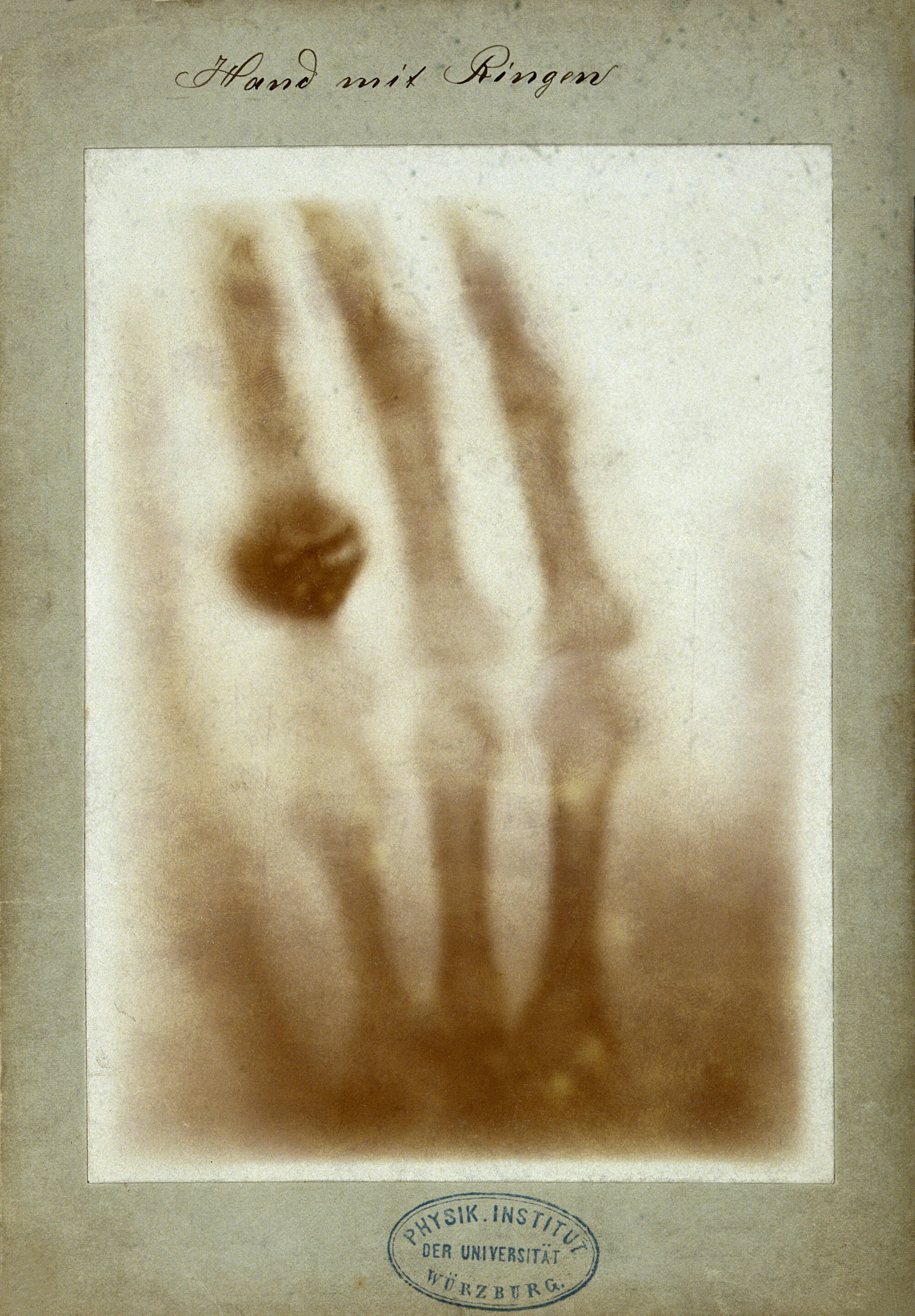 Radiograph of the left hand of Anna Bertha Röntgen, dated 22 December 1895: the print inscribed Hand mit Ringen that Röntgen gave to Ludwig Zehnder, with the stamp of the Physikalisches Institut of Würzburg (Wellcome Collection).